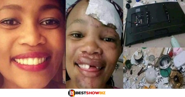 Boyfriend removes the teeth of his girl after the girl destroyed his room for cheating on her (photos)